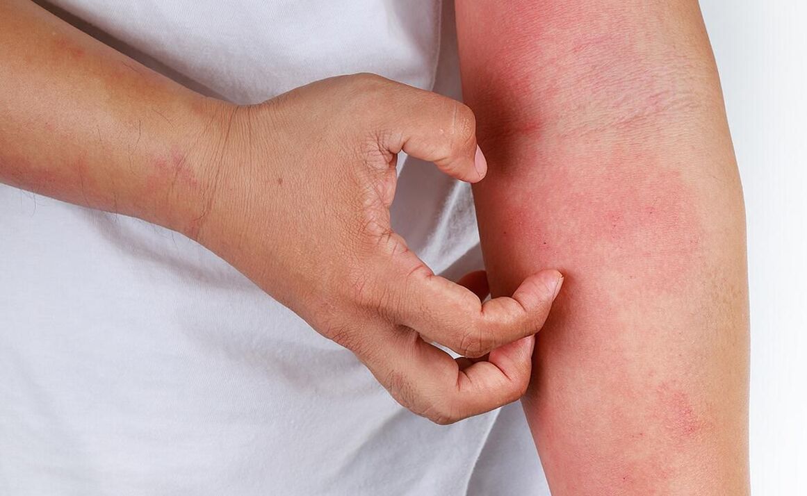 soda erabiltzearen konplikazio posibleak