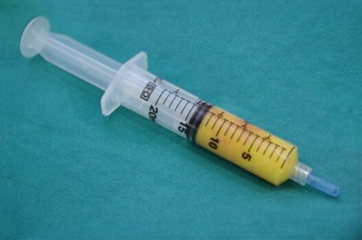 Lipofilling egiteko ehun adiposodun xiringa
